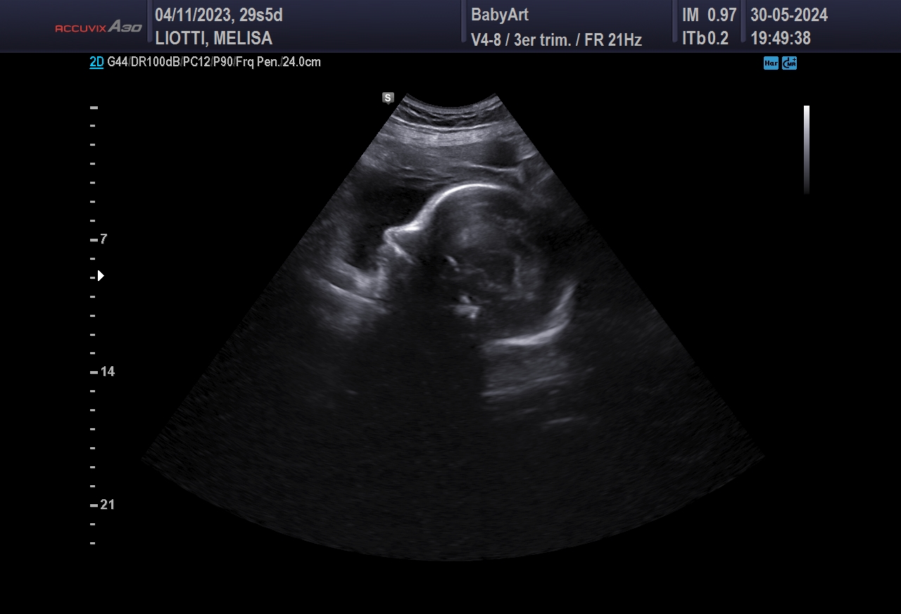 JULIA DE MELISA LIOTTI_0028.JPG